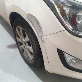 Hyundai car dent & paint and Scratch repair in Nottingham by Scratchmaster: Click Here To View Larger Image